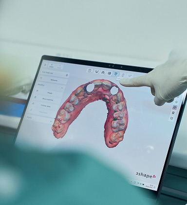 Protesi - Studio Dentistico Vedove Soda